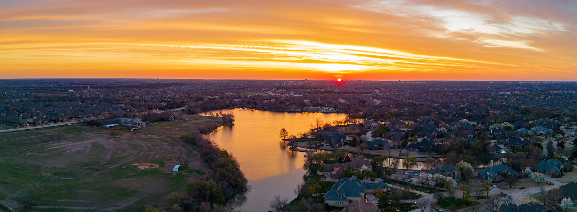 Restoration Dental | Dental Fillings, Oral Exams and Digital Radiography