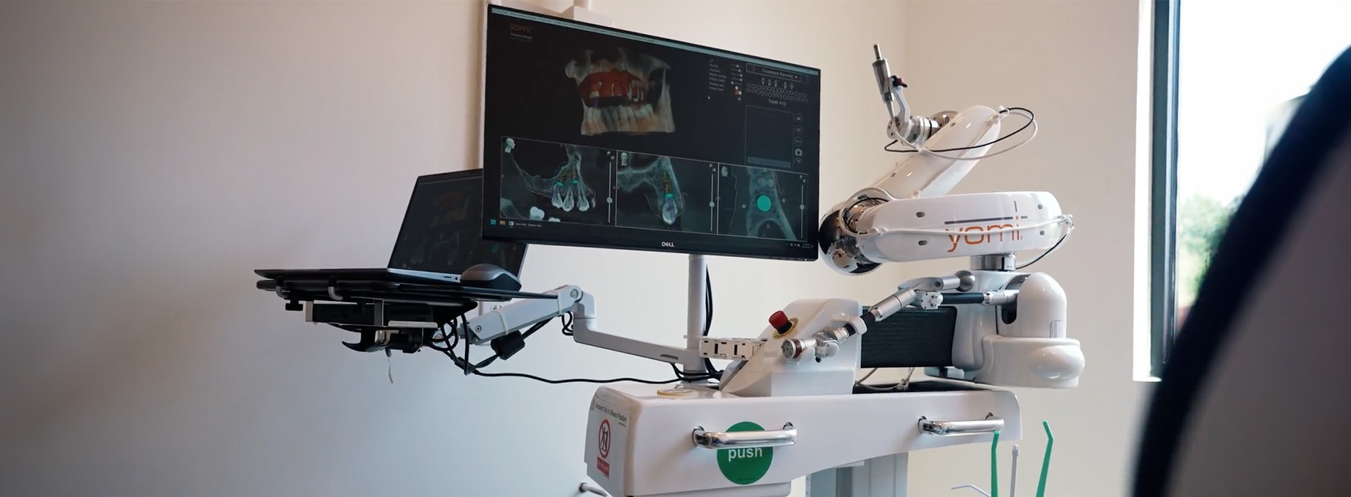 Restoration Dental | Digital Radiography, Periodontal Treatment and Extractions